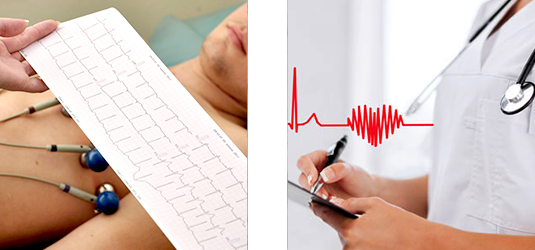 cc electrocardiograma